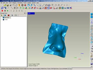 Winning the Battle Against Cancer